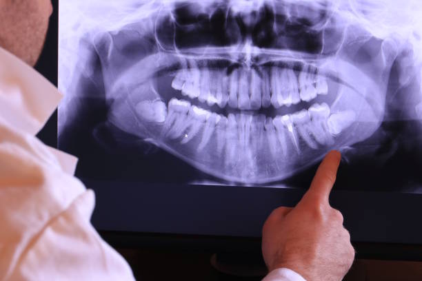 Best Holiday Emergency Dentist in Hebron, MD