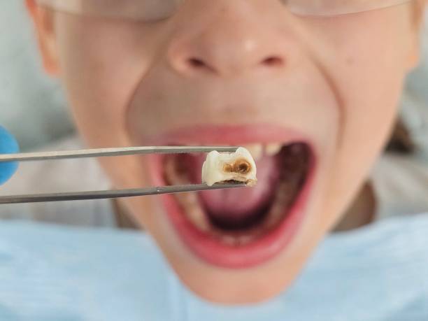 Best Pediatric Emergency Dentist in Hebron, MD